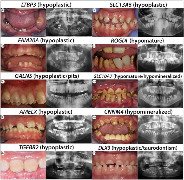 https://cdn.ncbi.nlm.nih.gov/pmc/blobs/677e/10205041/02aa4cffe403/fphys-14-1130175-g005.jpg
