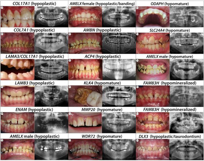 https://cdn.ncbi.nlm.nih.gov/pmc/blobs/677e/10205041/85d709dcfec6/fphys-14-1130175-g004.jpg