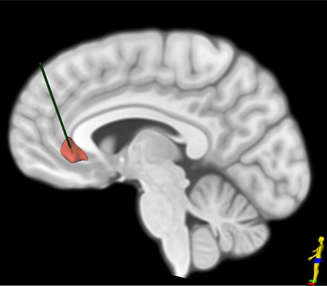 https://cdn.ncbi.nlm.nih.gov/pmc/blobs/677e/10940557/286b3534fac1/44192_2024_62_Fig1_HTML.jpg