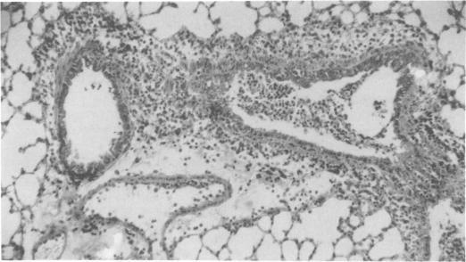 https://cdn.ncbi.nlm.nih.gov/pmc/blobs/677f/421352/8bff0876d922/iai00205-0236-a.jpg
