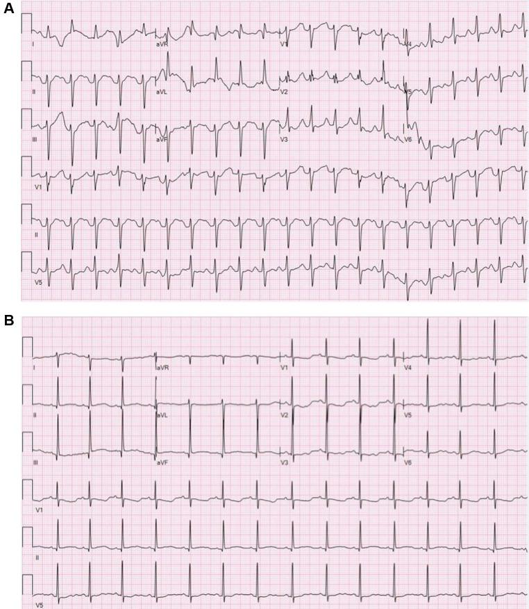 https://cdn.ncbi.nlm.nih.gov/pmc/blobs/6788/10337585/0a6809ed26d7/fped-11-1168619-g001.jpg