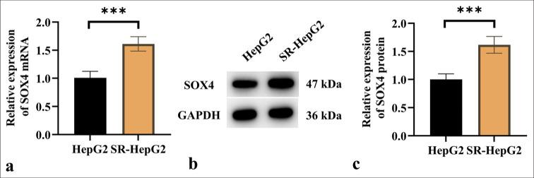 https://cdn.ncbi.nlm.nih.gov/pmc/blobs/678b/12289110/ce1d9a4717b0/Cytojournal-22-56-g001.jpg