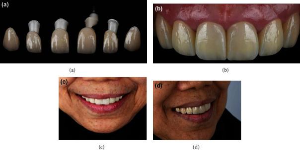 https://cdn.ncbi.nlm.nih.gov/pmc/blobs/6790/9233610/716313250553/CRID2022-8836068.007.jpg