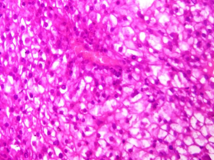 https://cdn.ncbi.nlm.nih.gov/pmc/blobs/6797/7495806/2f571dfdbc8f/CCR3-8-1659-g004.jpg