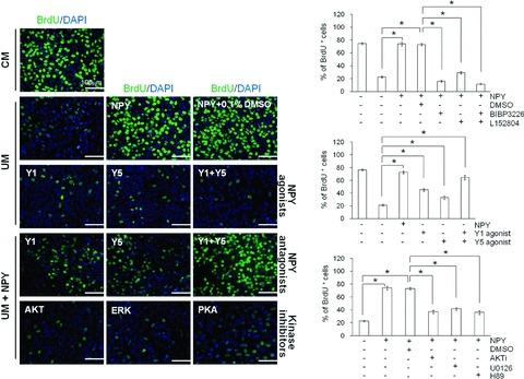 https://cdn.ncbi.nlm.nih.gov/pmc/blobs/679f/3822502/e11dc5589a64/jcmm0015-0152-f4.jpg