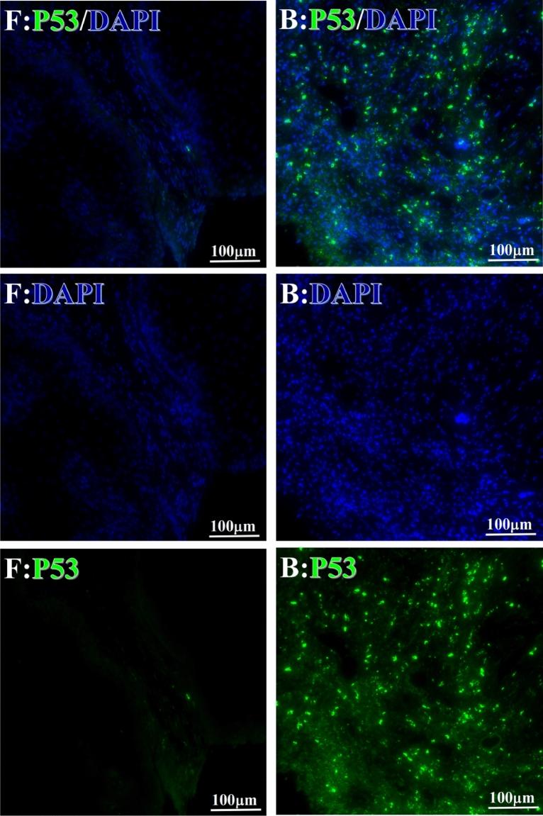 https://cdn.ncbi.nlm.nih.gov/pmc/blobs/67a1/10279707/10921cf34c92/41598_2023_36757_Fig12_HTML.jpg