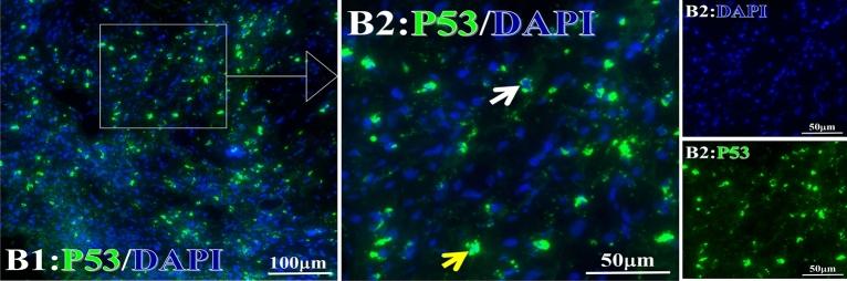 https://cdn.ncbi.nlm.nih.gov/pmc/blobs/67a1/10279707/52b961cc0022/41598_2023_36757_Fig23_HTML.jpg