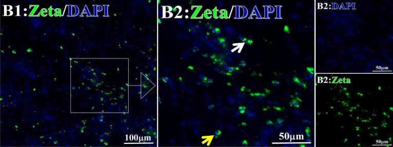 https://cdn.ncbi.nlm.nih.gov/pmc/blobs/67a1/10279707/64953cba5827/41598_2023_36757_Fig17_HTML.jpg