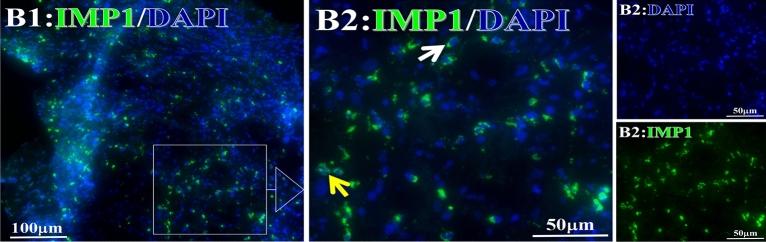 https://cdn.ncbi.nlm.nih.gov/pmc/blobs/67a1/10279707/ae856bfb8d3d/41598_2023_36757_Fig21_HTML.jpg