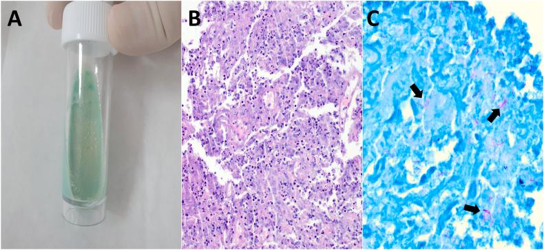 https://cdn.ncbi.nlm.nih.gov/pmc/blobs/67a3/11532853/e0e19b0f106b/gr2.jpg