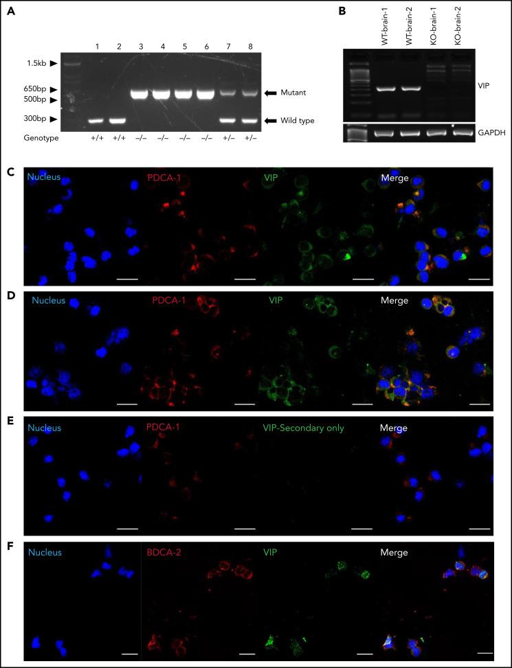 https://cdn.ncbi.nlm.nih.gov/pmc/blobs/67a9/9507007/fe5831dce9fd/bloodBLD2021012561f1.jpg