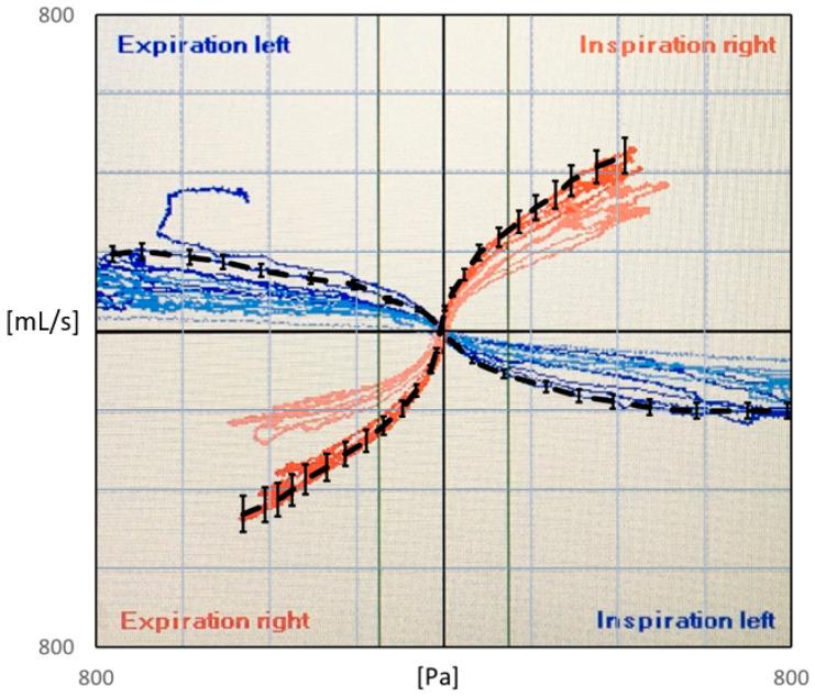 https://cdn.ncbi.nlm.nih.gov/pmc/blobs/67aa/10967811/5ec0238a8b69/bioengineering-11-00239-g001.jpg