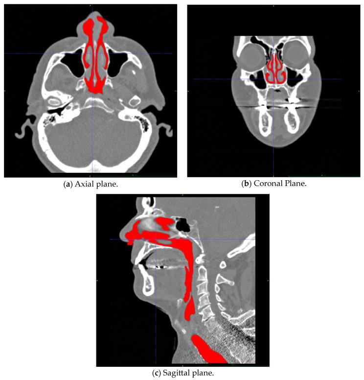 https://cdn.ncbi.nlm.nih.gov/pmc/blobs/67aa/10967811/ce4100bbf2db/bioengineering-11-00239-g004.jpg