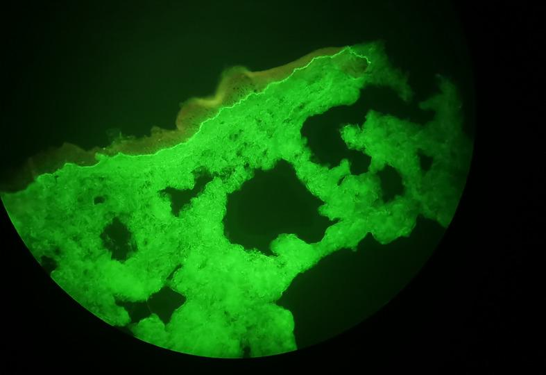 https://cdn.ncbi.nlm.nih.gov/pmc/blobs/67bb/9524245/b61b0d1d07f2/fimmu-13-984132-g001.jpg
