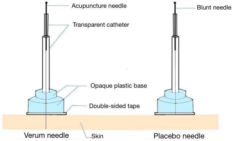 https://cdn.ncbi.nlm.nih.gov/pmc/blobs/67c7/12399894/5f43bb93361d/JPR-18-4387-g0003.jpg