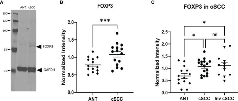 https://cdn.ncbi.nlm.nih.gov/pmc/blobs/67c9/8869607/3549c2b3b740/fonc-12-819580-g004.jpg