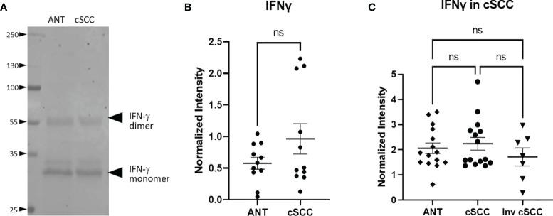 https://cdn.ncbi.nlm.nih.gov/pmc/blobs/67c9/8869607/e865cf46bc48/fonc-12-819580-g003.jpg