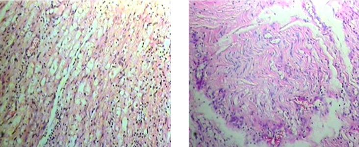 https://cdn.ncbi.nlm.nih.gov/pmc/blobs/67ce/3860672/6ddf5c69ce51/traumamon-18-98-g002.jpg