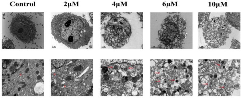 https://cdn.ncbi.nlm.nih.gov/pmc/blobs/67d3/10386594/5ddcb9d61116/toxics-11-00607-g002.jpg