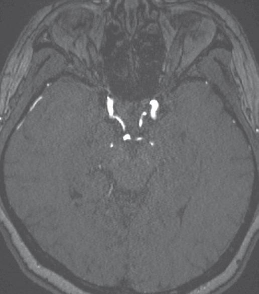https://cdn.ncbi.nlm.nih.gov/pmc/blobs/67d3/5709899/39be82935b3a/JNRP-8-664-g003.jpg