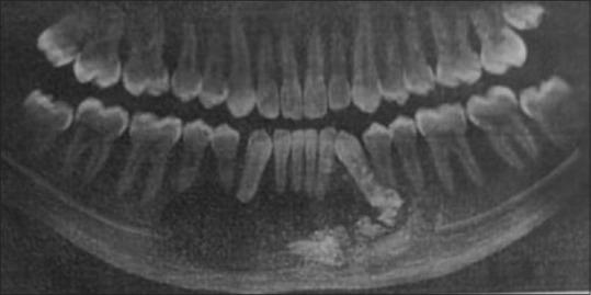 https://cdn.ncbi.nlm.nih.gov/pmc/blobs/67d6/10112690/e9b8fe80099b/JOMFP-27-69-g001.jpg