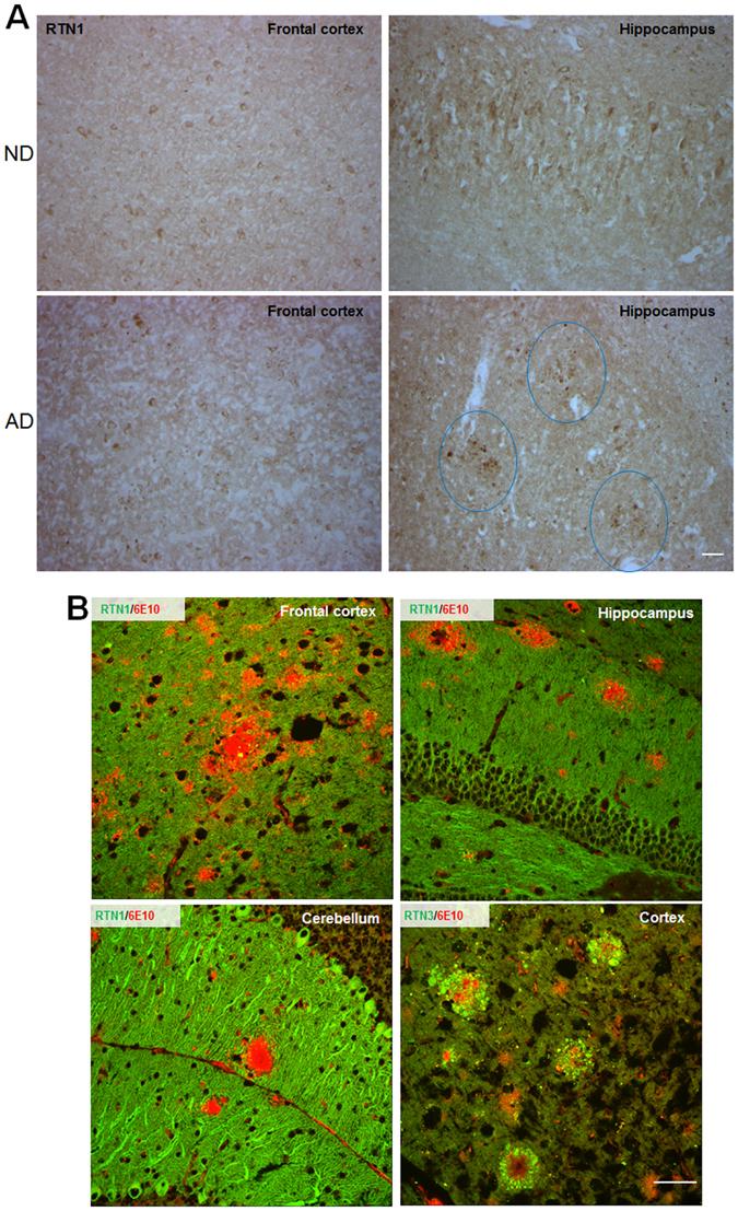 https://cdn.ncbi.nlm.nih.gov/pmc/blobs/67d6/5522448/df2b918195b9/41598_2017_5504_Fig5_HTML.jpg