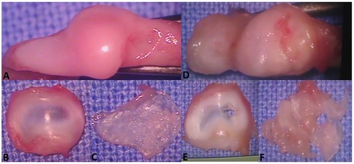 https://cdn.ncbi.nlm.nih.gov/pmc/blobs/67db/7159193/f616322dcffe/pone.0231734.g003.jpg