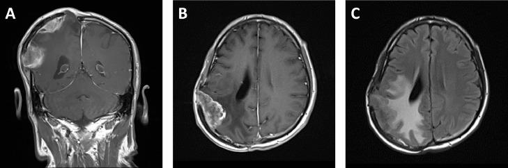 https://cdn.ncbi.nlm.nih.gov/pmc/blobs/67e0/7198915/fd2751724a10/gr2.jpg