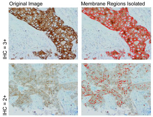 https://cdn.ncbi.nlm.nih.gov/pmc/blobs/67e1/2447833/b3a1091c8929/1471-2342-8-11-4.jpg