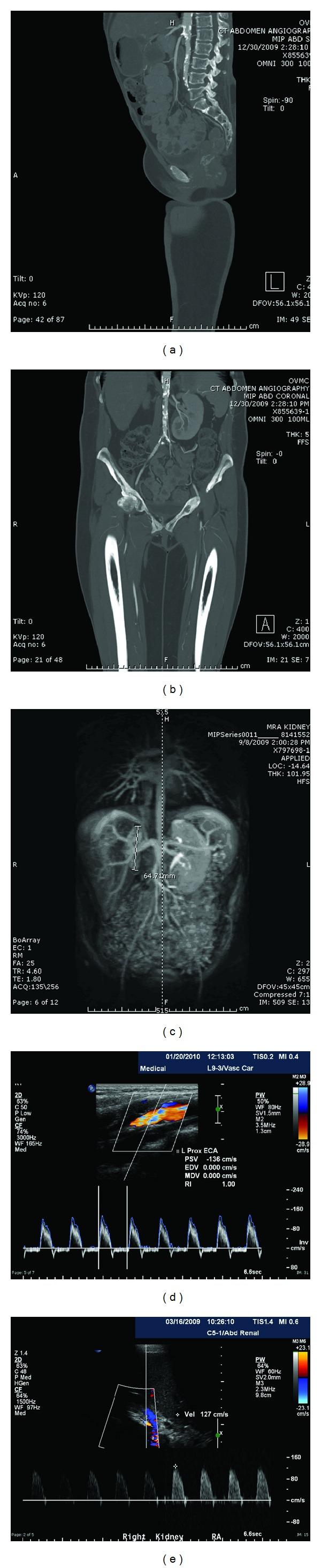 https://cdn.ncbi.nlm.nih.gov/pmc/blobs/67ea/3521621/b7693204623d/CRIM2012-839795.001.jpg