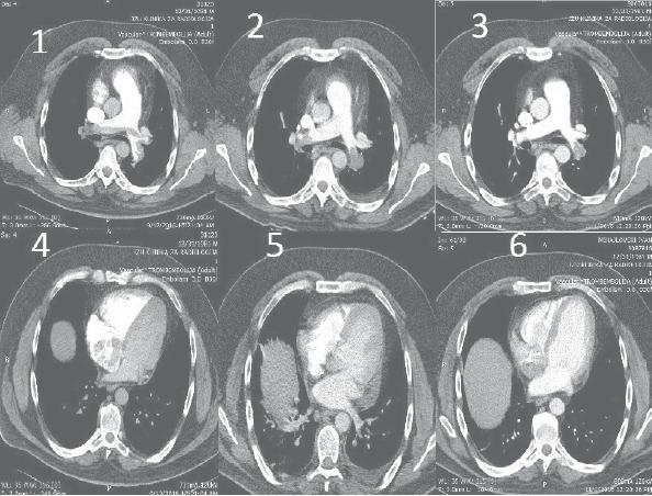 https://cdn.ncbi.nlm.nih.gov/pmc/blobs/67eb/5512203/0e8244567c9a/AJC-18-77-g002.jpg