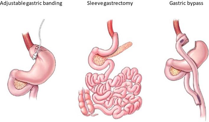 https://cdn.ncbi.nlm.nih.gov/pmc/blobs/67f4/11343883/6e937be7303e/40265_2024_2029_Fig2_HTML.jpg