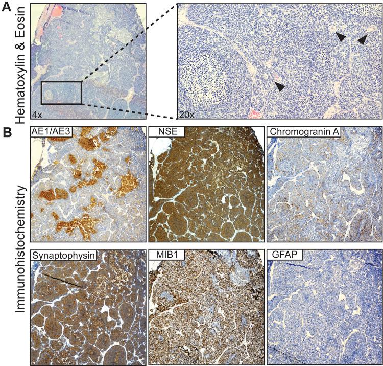 https://cdn.ncbi.nlm.nih.gov/pmc/blobs/67f8/10701755/5008cca58e21/CASE23164f2.jpg