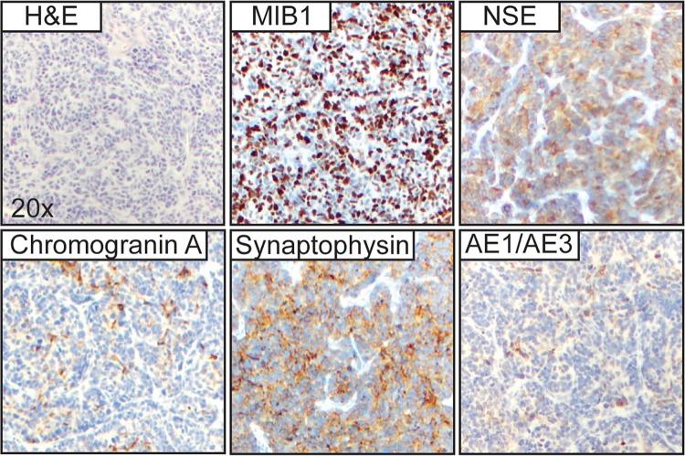 https://cdn.ncbi.nlm.nih.gov/pmc/blobs/67f8/10701755/85ee05595abc/CASE23164f3.jpg