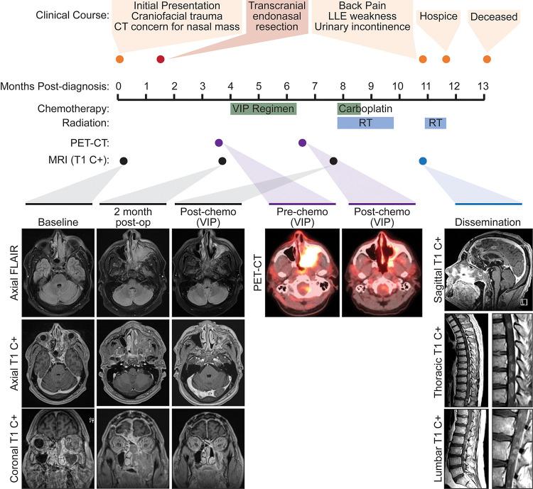 https://cdn.ncbi.nlm.nih.gov/pmc/blobs/67f8/10701755/e8d1e4c8d408/CASE23164f1.jpg
