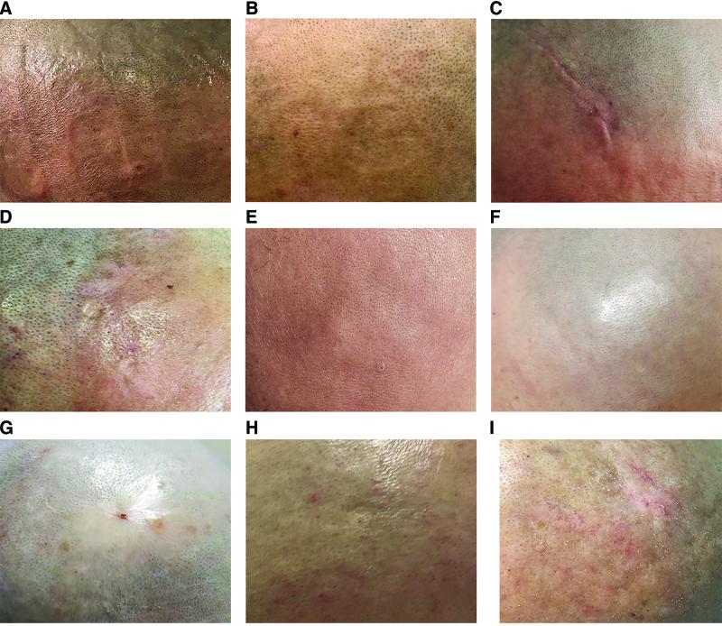 https://cdn.ncbi.nlm.nih.gov/pmc/blobs/6805/10194479/1ce0d40f2f3c/medi-102-e33830-g003.jpg