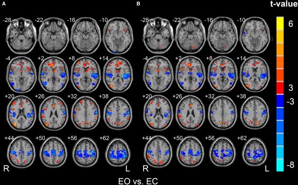https://cdn.ncbi.nlm.nih.gov/pmc/blobs/6806/2893000/3fc0dabddd20/fnsys-04-00024-g004.jpg