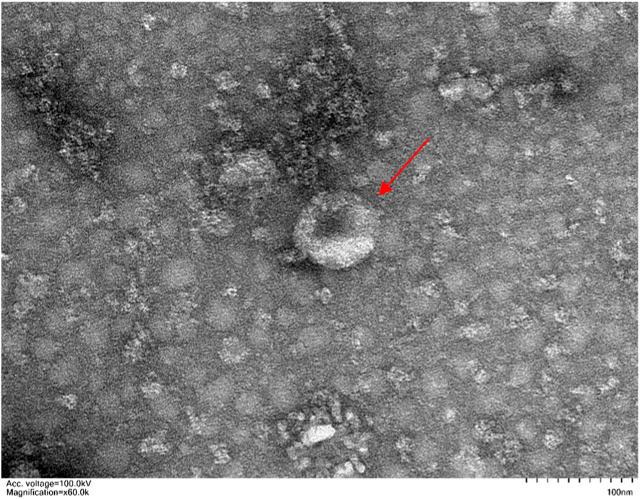 https://cdn.ncbi.nlm.nih.gov/pmc/blobs/680d/10204869/acb191af5f0d/fbioe-11-1167012-g001.jpg