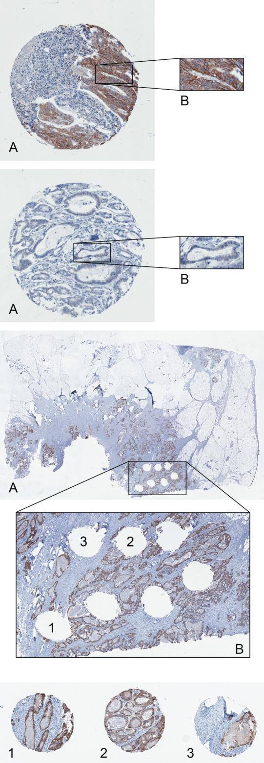 https://cdn.ncbi.nlm.nih.gov/pmc/blobs/680e/4785607/4de98c018fd2/PATH-238-562-g001.jpg