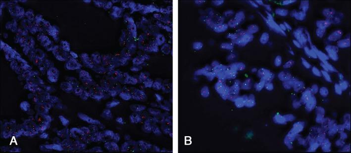 https://cdn.ncbi.nlm.nih.gov/pmc/blobs/680e/4785607/754fcad845a9/PATH-238-562-g002.jpg