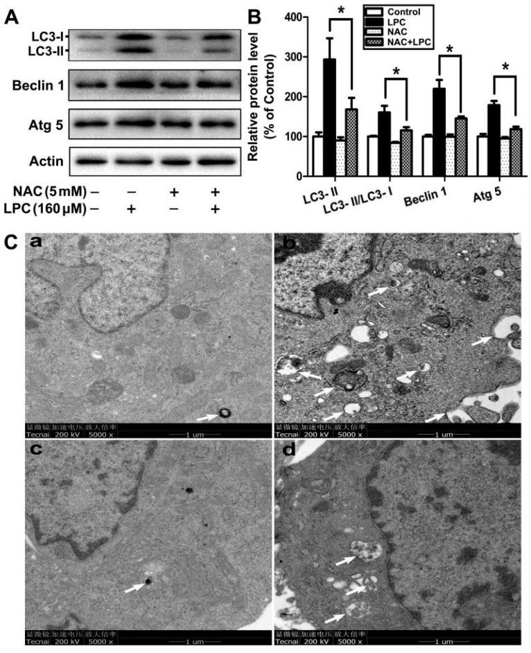 https://cdn.ncbi.nlm.nih.gov/pmc/blobs/681f/8835979/495e4306d2c2/ijms-23-01479-g005.jpg