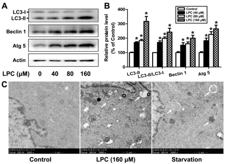 https://cdn.ncbi.nlm.nih.gov/pmc/blobs/681f/8835979/b3892c77c019/ijms-23-01479-g002.jpg