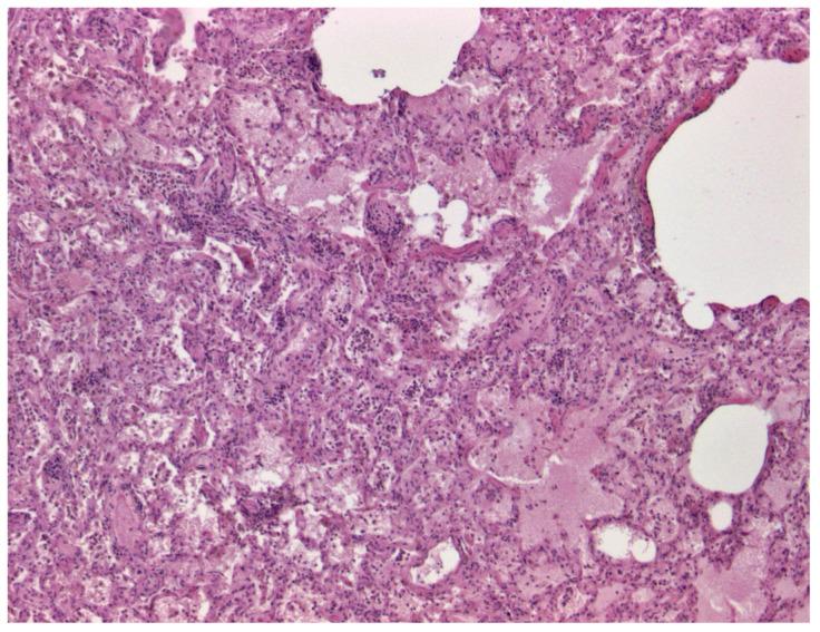 https://cdn.ncbi.nlm.nih.gov/pmc/blobs/6821/11860487/5c68e1abb8d7/viruses-17-00159-g001.jpg