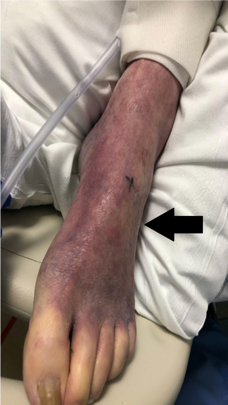 https://cdn.ncbi.nlm.nih.gov/pmc/blobs/6823/7105036/3a94cde61da4/cureus-0012-00000007443-i01.jpg