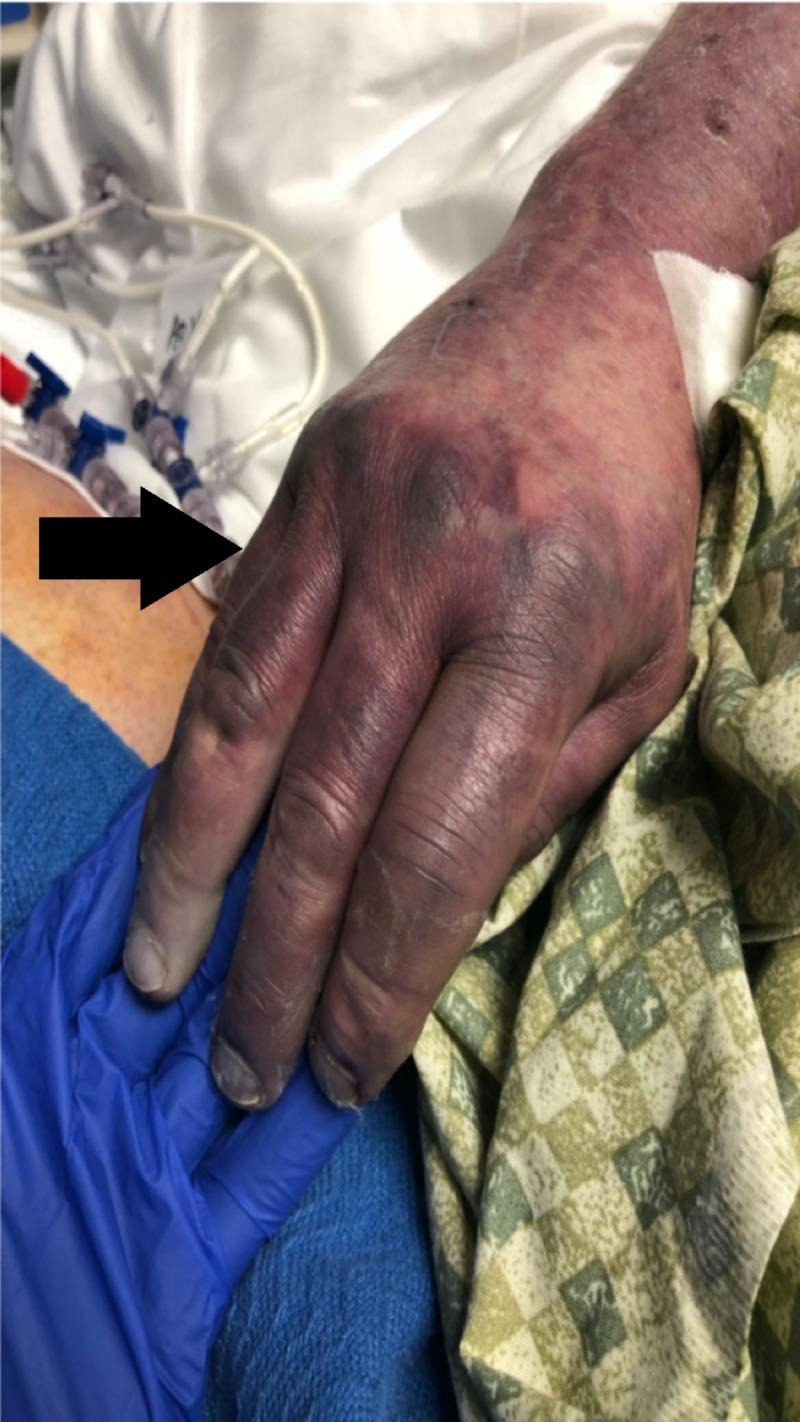 https://cdn.ncbi.nlm.nih.gov/pmc/blobs/6823/7105036/d5d58194008c/cureus-0012-00000007443-i02.jpg