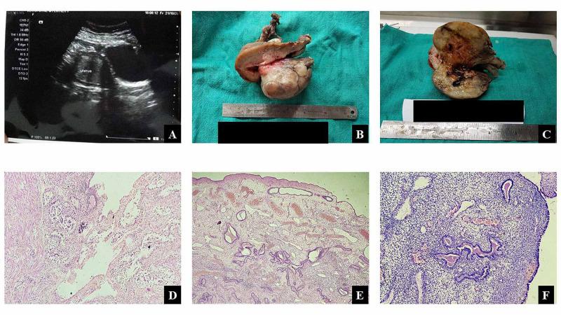 https://cdn.ncbi.nlm.nih.gov/pmc/blobs/6823/7891803/7ab3fea3a72c/cureus-0013-00000012789-i01.jpg