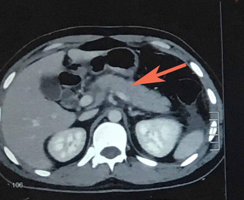 https://cdn.ncbi.nlm.nih.gov/pmc/blobs/6825/7805493/f95c5beef734/cureus-0012-00000012103-i01.jpg