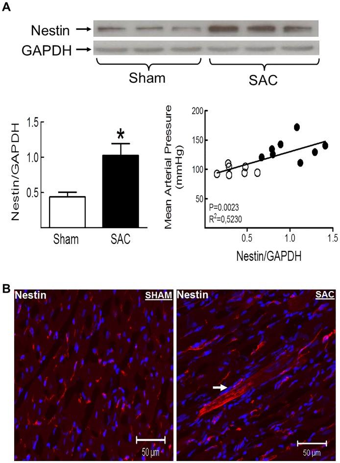 https://cdn.ncbi.nlm.nih.gov/pmc/blobs/6828/5407835/32f4f03c39fd/pone.0176147.g002.jpg