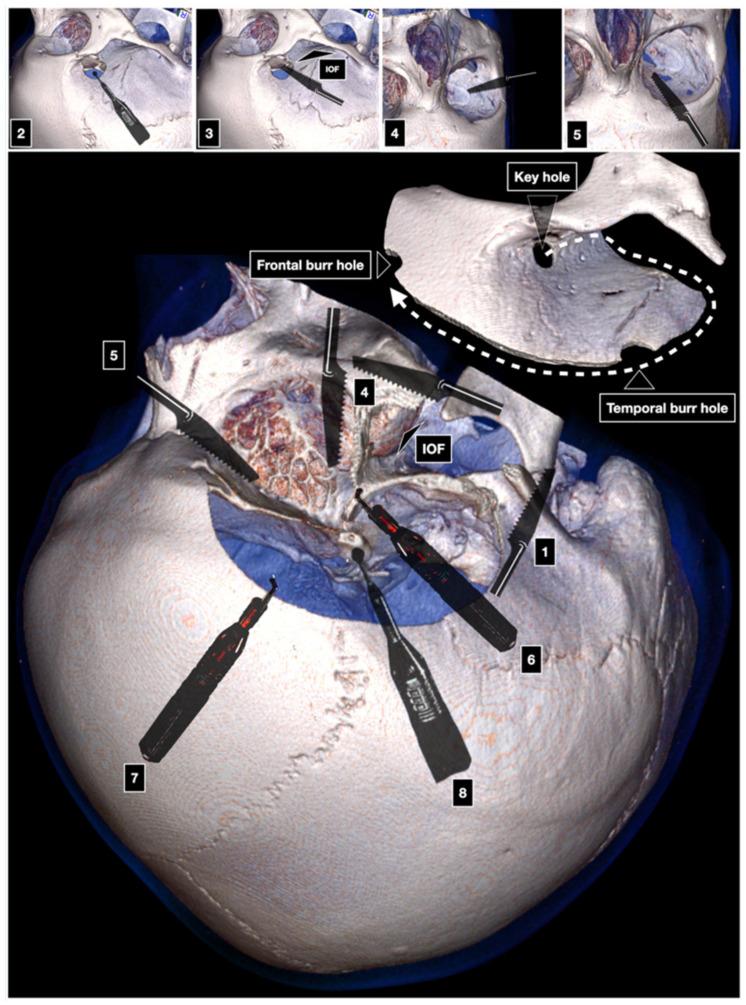 https://cdn.ncbi.nlm.nih.gov/pmc/blobs/682b/8946068/0535ae3f66ab/brainsci-12-00405-g003.jpg