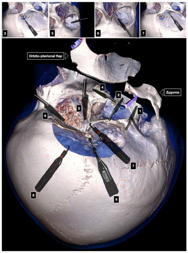https://cdn.ncbi.nlm.nih.gov/pmc/blobs/682b/8946068/11af0d2e128d/brainsci-12-00405-g005.jpg